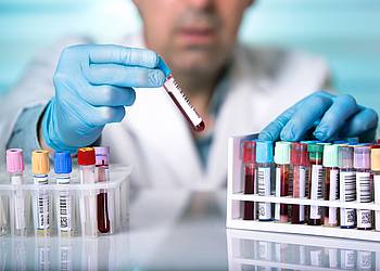 Labormediziner testet Blutprobe auf HIV