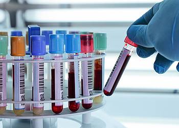 Teströhrchen mit Blut im Labor. 