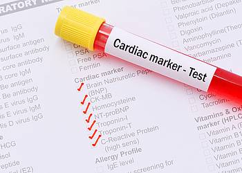 Blutröhrchen mit Laboranforderung für Tests auf Herzinfarkt