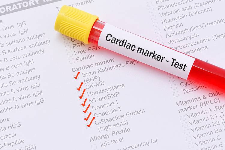 Blutröhrchen mit Laboranforderung für Tests auf Herzinfarkt