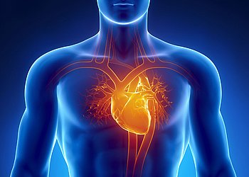 Schematische Darstellung eines männlichen Oberkörpers mit farblich hervorgehobenem Bereich rund um das Herz zur Verdeutlichung von Herz- Kreislauf- Erkrankungen. 