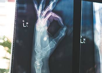 Röntgenbild einer Hand