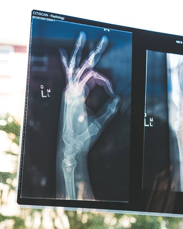 Röntgenbild einer Hand