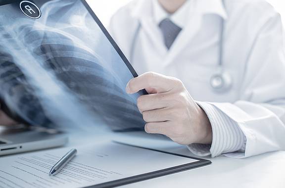 Arzt betrachtet Röntgenbild von Lunge mit Verdacht auf Tuberkulose.