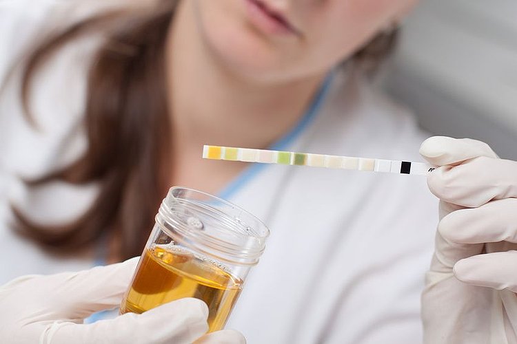 Laborantin untersucht Urinprobe auf Harnwegsinfekte
