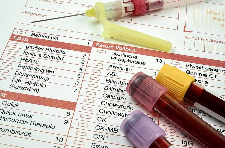 Blutproben liegen auf einem Diagnosezettel