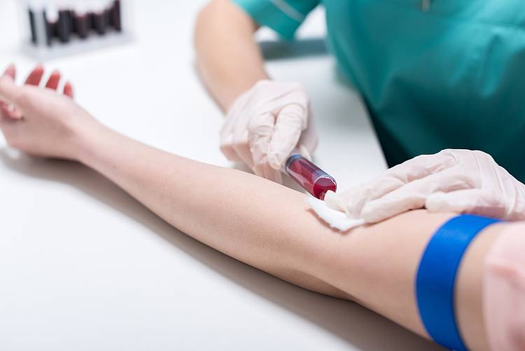 Blutabnahme zum D-Dimere-Test wegen Thrombose-Verdacht